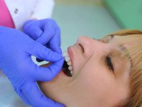 Closeup of dentist placing veneer on patient's teeth